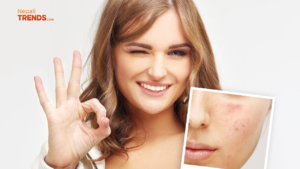 health benefits of pomegranate peels- prevents acne